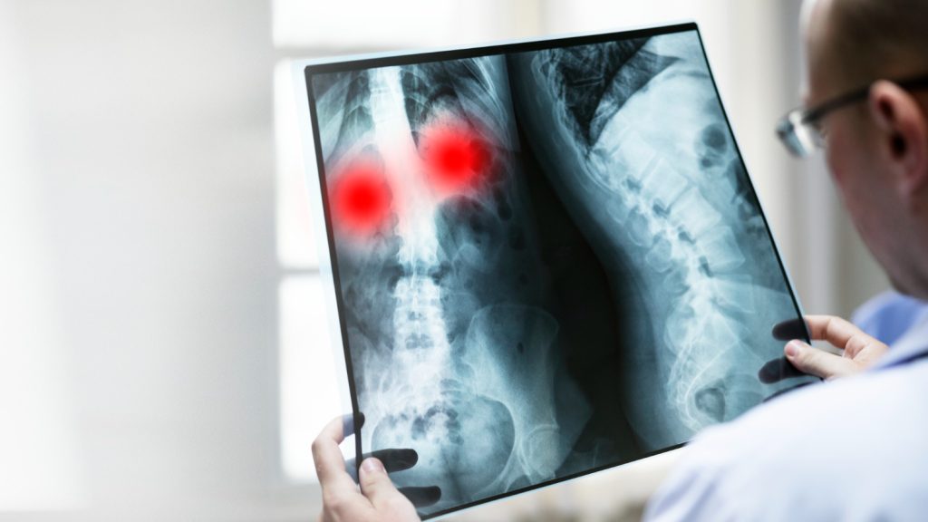 On Site X-Ray in Ogden